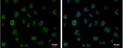 Immunocytochemistry/ Immunofluorescence: FUBP1 Antibody [NBP2-16542]