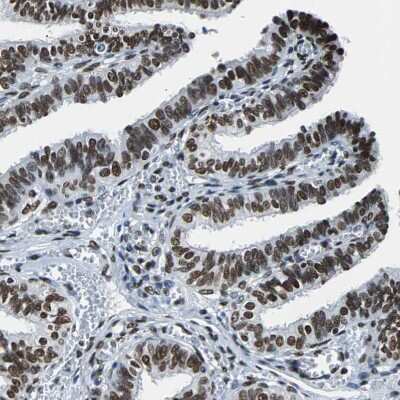 Immunohistochemistry-Paraffin: FUBP1 Antibody [NBP1-83918]