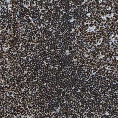 Immunohistochemistry-Paraffin: FUBP1 Antibody [NBP1-83918]
