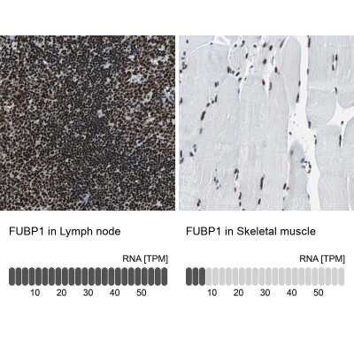 Immunohistochemistry-Paraffin: FUBP1 Antibody [NBP1-83918]