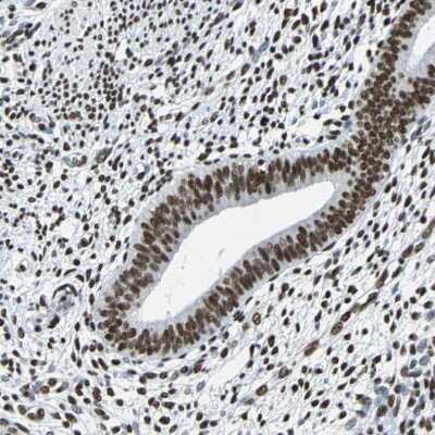 Immunohistochemistry-Paraffin: FUBP1 Antibody [NBP1-83918]