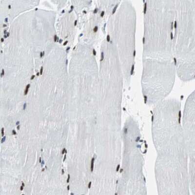 Immunohistochemistry-Paraffin: FUBP1 Antibody [NBP1-83918]