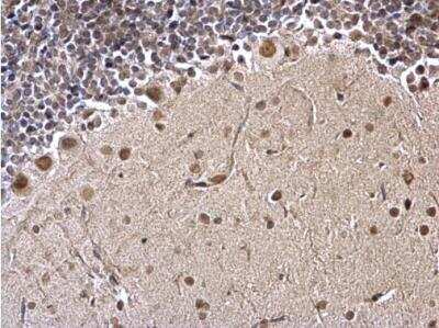 Immunohistochemistry-Paraffin: FUBP1 Antibody [NBP2-16542]