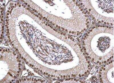Immunohistochemistry-Paraffin: FUBP1 Antibody [NBP2-16542]