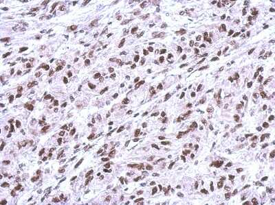 Immunohistochemistry-Paraffin: FUBP1 Antibody [NBP2-16543]