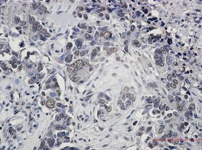 Immunohistochemistry-Paraffin: FUBP1 Antibody (S06-4F3) [NBP3-19639]