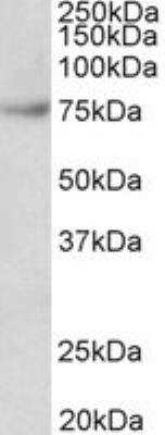 Western Blot: FUBP1 Antibody [NBP2-26146]