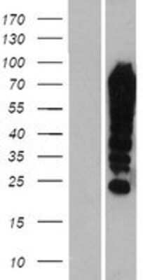 Western Blot: FUBP1 Overexpression Lysate [NBP2-07937]