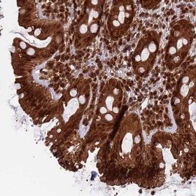Immunohistochemistry-Paraffin: FUBP3 Antibody [NBP2-14030]