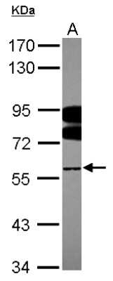 Western Blot: FUBP3 Antibody [NBP2-16544]