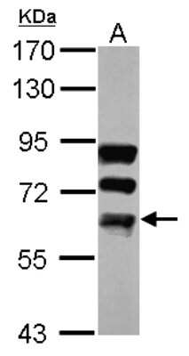 Western Blot: FUBP3 Antibody [NBP2-16545]