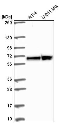 Western Blot: FUBP3 Antibody [NBP2-58466]