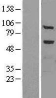 Western Blot: Tissue alpha-L-Fucosidase/FUCA1 Overexpression Lysate [NBL1-10855]