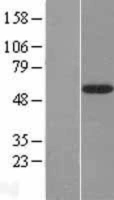 Western Blot: FUCA2 Overexpression Lysate [NBL1-10856]