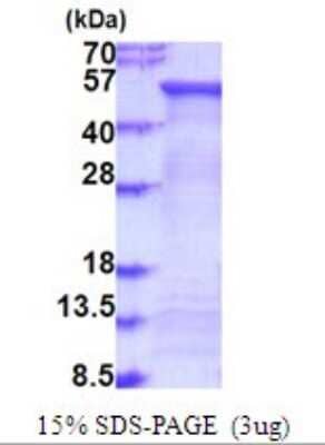 SDS-PAGE: Recombinant Human FUCA2 His Protein [NBP2-51910]