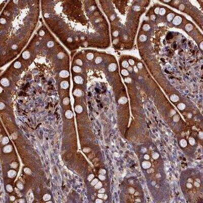 Immunohistochemistry-Paraffin: FUK Antibody [NBP1-83467]