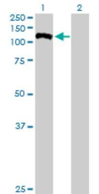 Western Blot: FUK Antibody [H00197258-B01P]