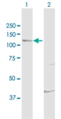 Western Blot: FUK Antibody [H00197258-D01P]