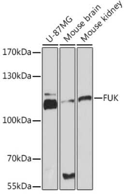 Western Blot: FUK AntibodyAzide and BSA Free [NBP3-15538]