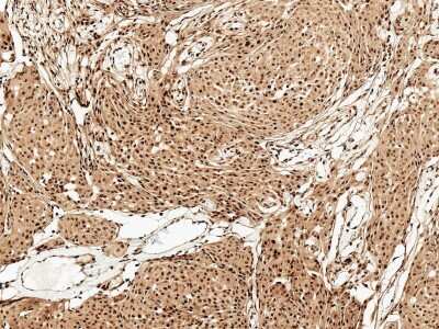 Immunohistochemistry: FUNDC1 Antibody [NBP3-18250]
