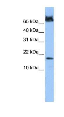 Western Blot: FUNDC1 Antibody [NBP1-55388]