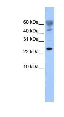 Western Blot: FUNDC1 Antibody [NBP1-56430]