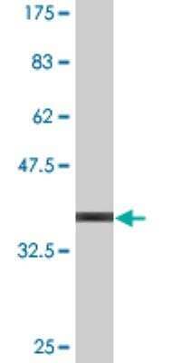 Western Blot: FUNDC2 Antibody (4D7) [H00065991-M19-100ug]