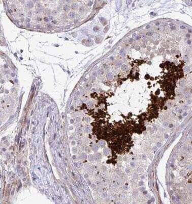 Immunohistochemistry-Paraffin: FUNDC2 Antibody [NBP2-31745]