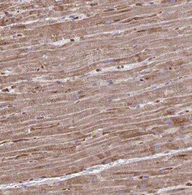 Immunohistochemistry-Paraffin: FUNDC2 Antibody [NBP2-31745]