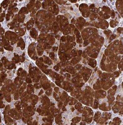 Immunohistochemistry-Paraffin: FUNDC2 Antibody [NBP2-31745]