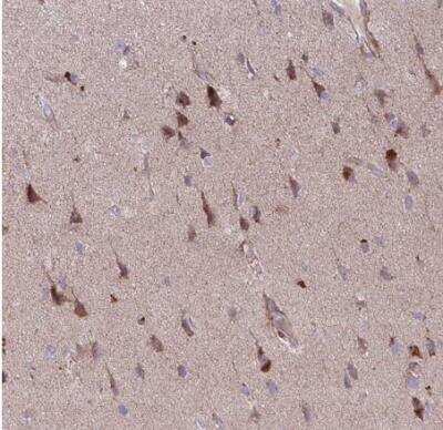 Immunohistochemistry-Paraffin: FUNDC2 Antibody [NBP2-31745]