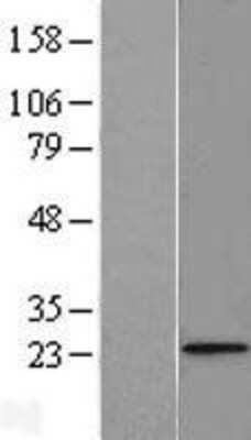 Western Blot: FUNDC2 Overexpression Lysate [NBL1-10859]