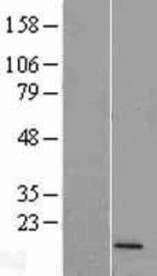 Western Blot: FUNDC2P2 Overexpression Lysate [NBL1-12598]