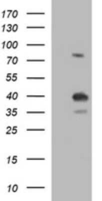 Western Blot: FUR1 Antibody (OTI2D1) [NBP2-46297]