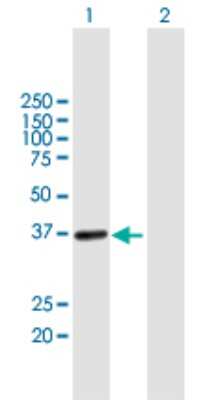 Western Blot: FUR1 Antibody [H00139596-B01P]