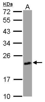 Western Blot: FUR1 Antibody [NBP2-16547]