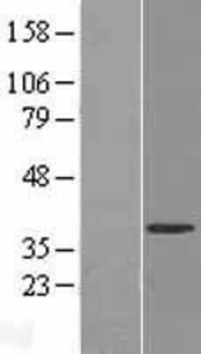 Western Blot: FUR1 Overexpression Lysate [NBL1-17627]