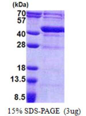 SDS-PAGE: Recombinant Human FUR1 His Protein [NBP2-22933]