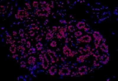 Immunohistochemistry: FUS Antibody (BLR023E) [NBP2-76415]