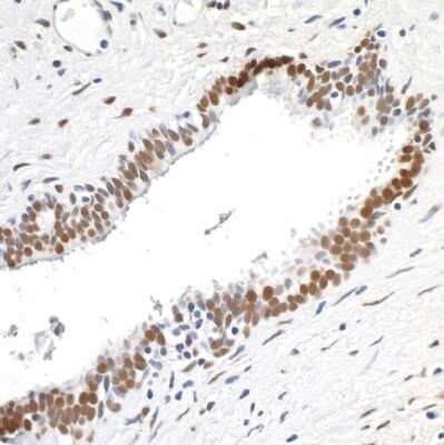 Immunohistochemistry-Paraffin: FUS Antibody (BLR023E) [NBP2-76415]