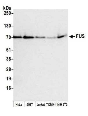 Western Blot: FUS Antibody (BLR023E) [NBP2-76415]