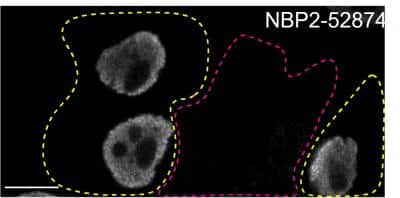 Knockout Validated: FUS Antibody (CL0190) [NBP2-52874]