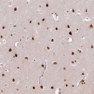 Immunohistochemistry-Paraffin: FUS Antibody (CL0190) [NBP2-52874]
