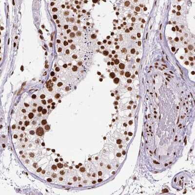 Immunohistochemistry-Paraffin: FUS Antibody (CL0190) [NBP2-52874]