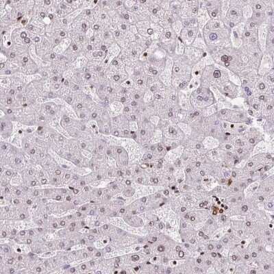 Immunohistochemistry-Paraffin: FUS Antibody (CL0190) [NBP2-52874]