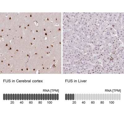 Immunohistochemistry-Paraffin: FUS Antibody (CL0190) [NBP2-52874]