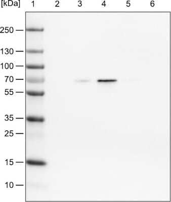 Western Blot: FUS Antibody (CL0190) [NBP2-52874]