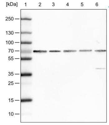 Western Blot: FUS Antibody (CL0190) [NBP2-52874]