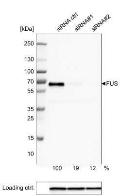 Knockdown Validated: FUS Antibody (CL0190) [NBP2-52874]