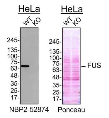 Knockout Validated: FUS Antibody (CL0190) [NBP2-52874]